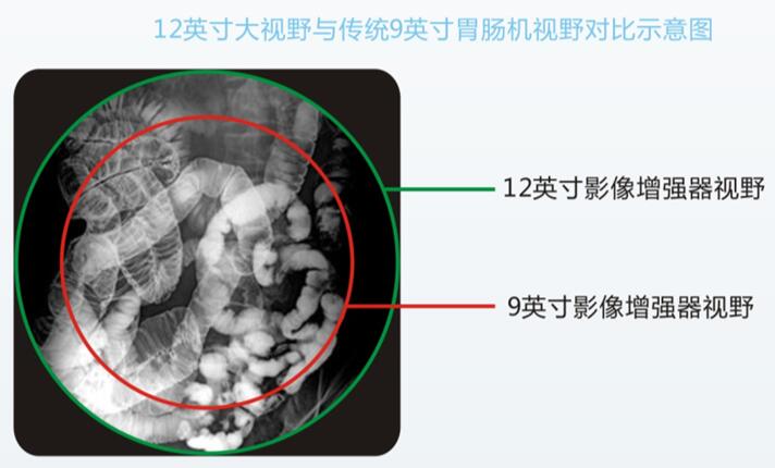 全數(shù)字胃腸機
