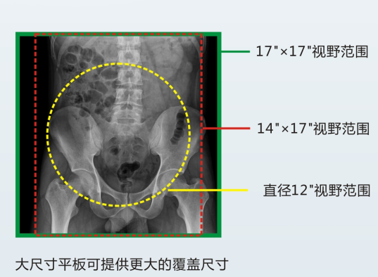 真正的動(dòng)態(tài)DR