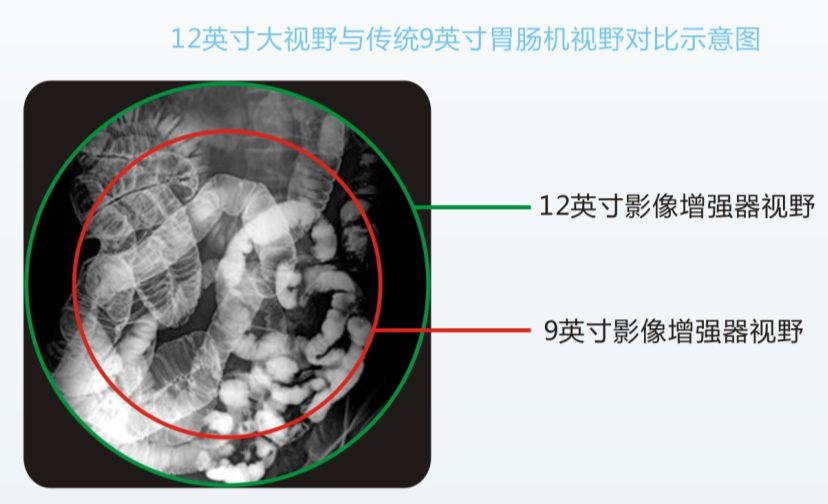 胃腸機(jī)檢查